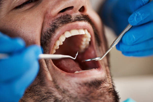 Best After-Hours Dental Care in Frostburg, MD